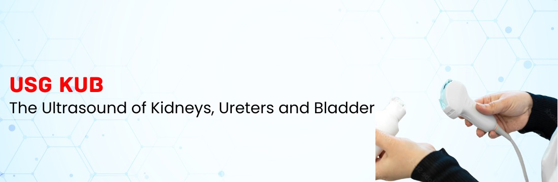 What is USG KUB? Understanding the Ultrasound of Kidneys, Ureters and Bladder